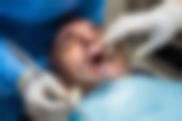 宁波北仑袁惠玲口腔诊所推出洗牙优惠活动，原价298元起现仅需198元起！