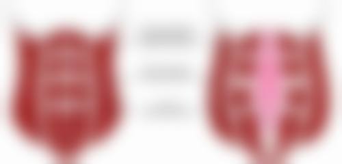 热玛吉和超声炮谁提升成效更胜一筹？再看治疗成效对比