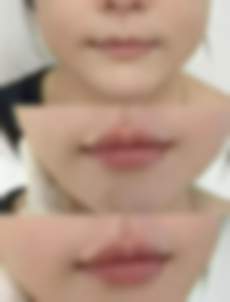 广州天河韩妃整形医院的口碑与技术实力