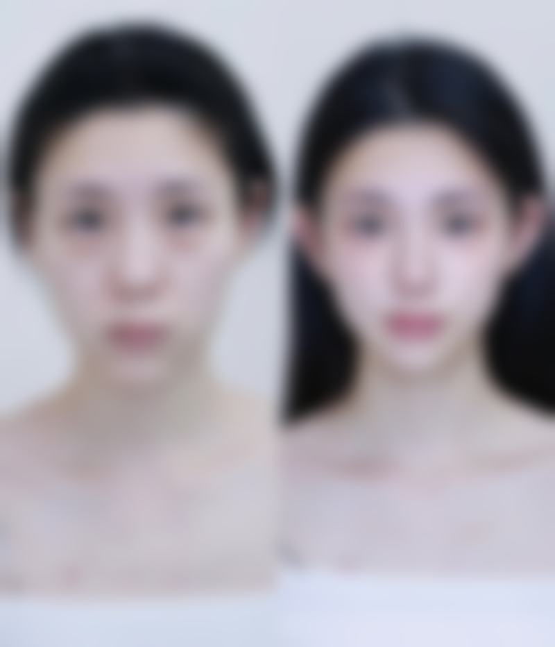 六、福州雍禾植发医疗美容门诊部价格表：（仅供参考）