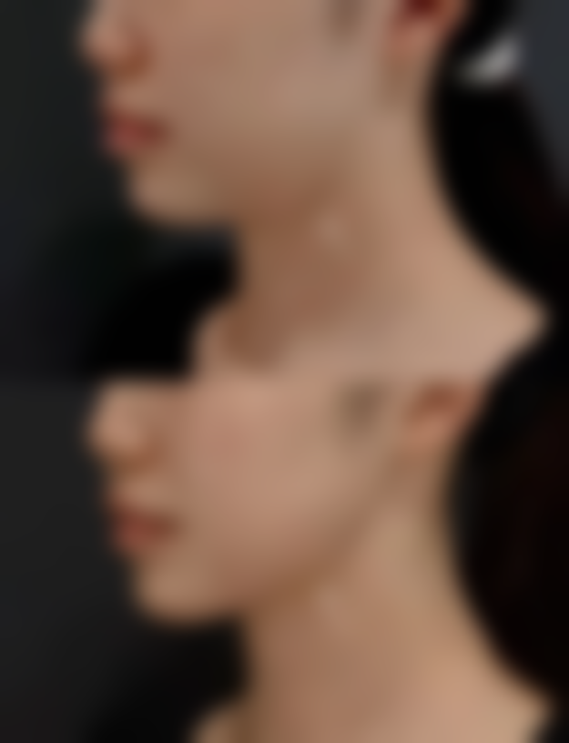 七、泉州丰泽亿星整形医疗美容门诊部价格表：（仅供参考）