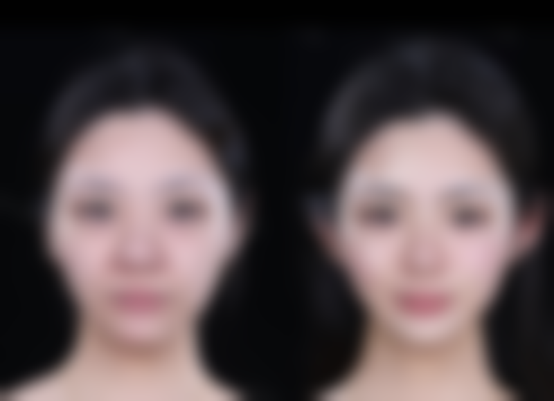 五、柳州美丽焦点医疗美容门诊部怎么预约：