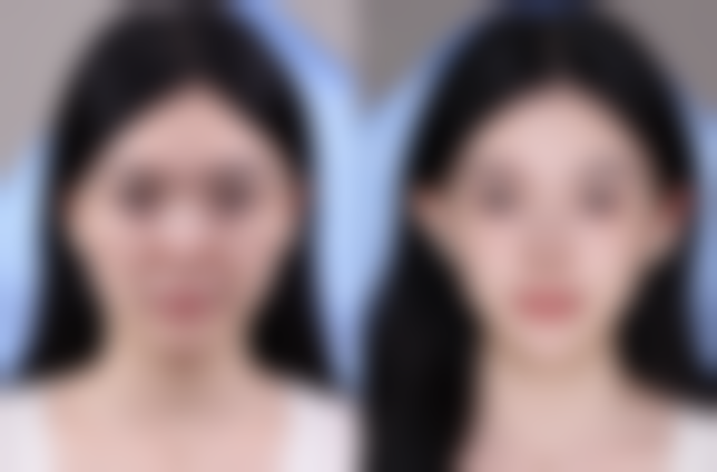 四、常德曹家整形医疗美容门诊部实例