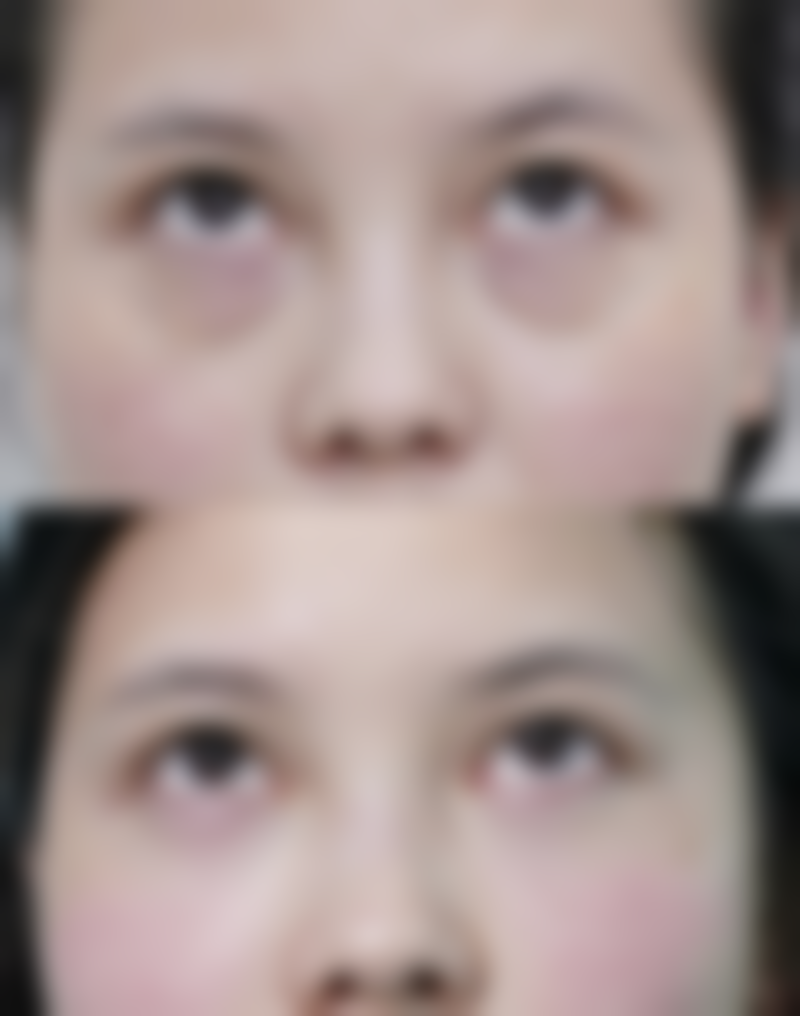 四、咸阳现代女子医院整形美容中 心实例