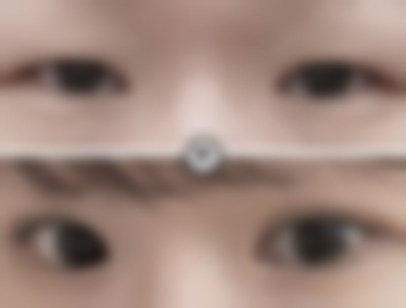 热玛吉和超声炮谁提升成效更胜一筹？然后看保持时间长短