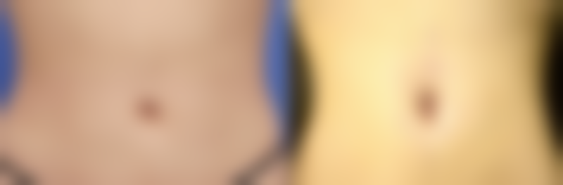 成都恒博植发医院的其他优点