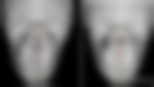 七、广州廉江人民医院颌面烧伤整形科价格表：（仅供参考）