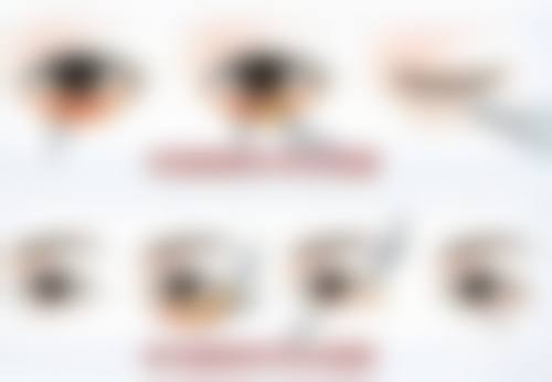 翁晓荣眼部综合整形水平怎么样可靠吗？