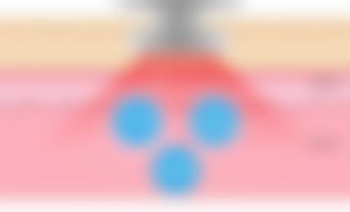 七、东莞俪颜整形医院真实的顾客评价如下：