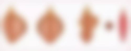 五、武汉民馨妇科医院医疗美容科怎么预约：