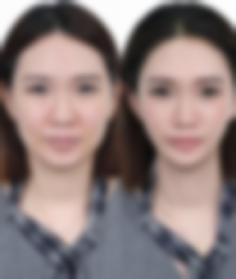 七、东莞植德医疗美容门诊部真实的顾客评价如下：