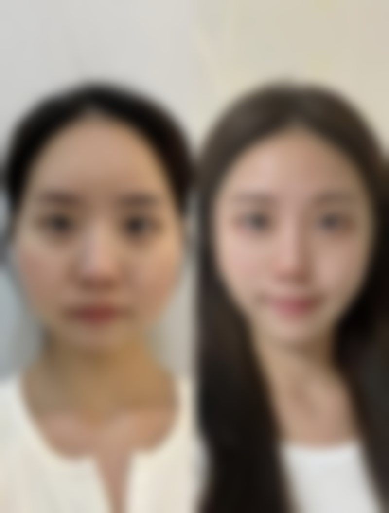 五、东莞俪颜整形医院怎么预约：