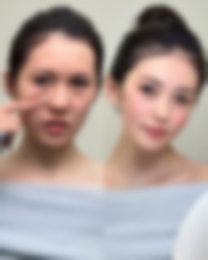 五、宁波市第六医院整形外科实例