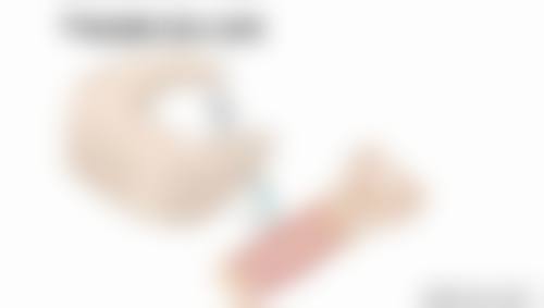 肖大谦自体脂肪隆胸实例