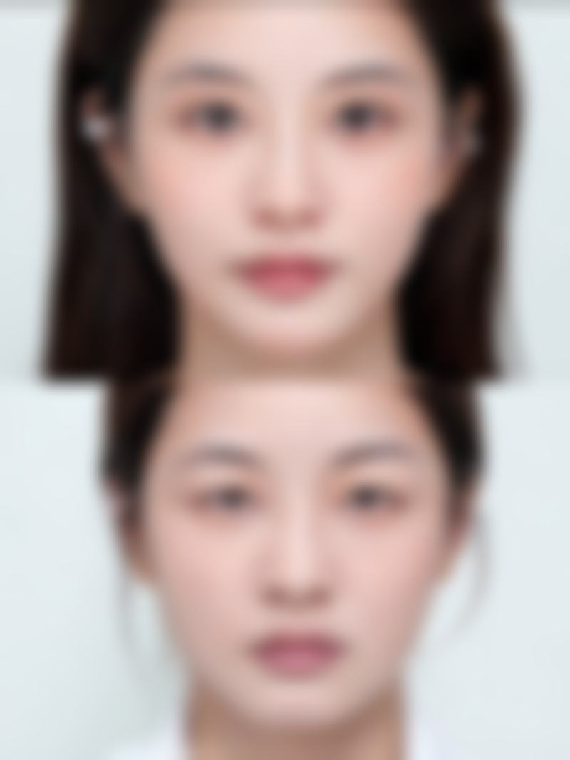 五、郑州同济医院毛发科怎么预约