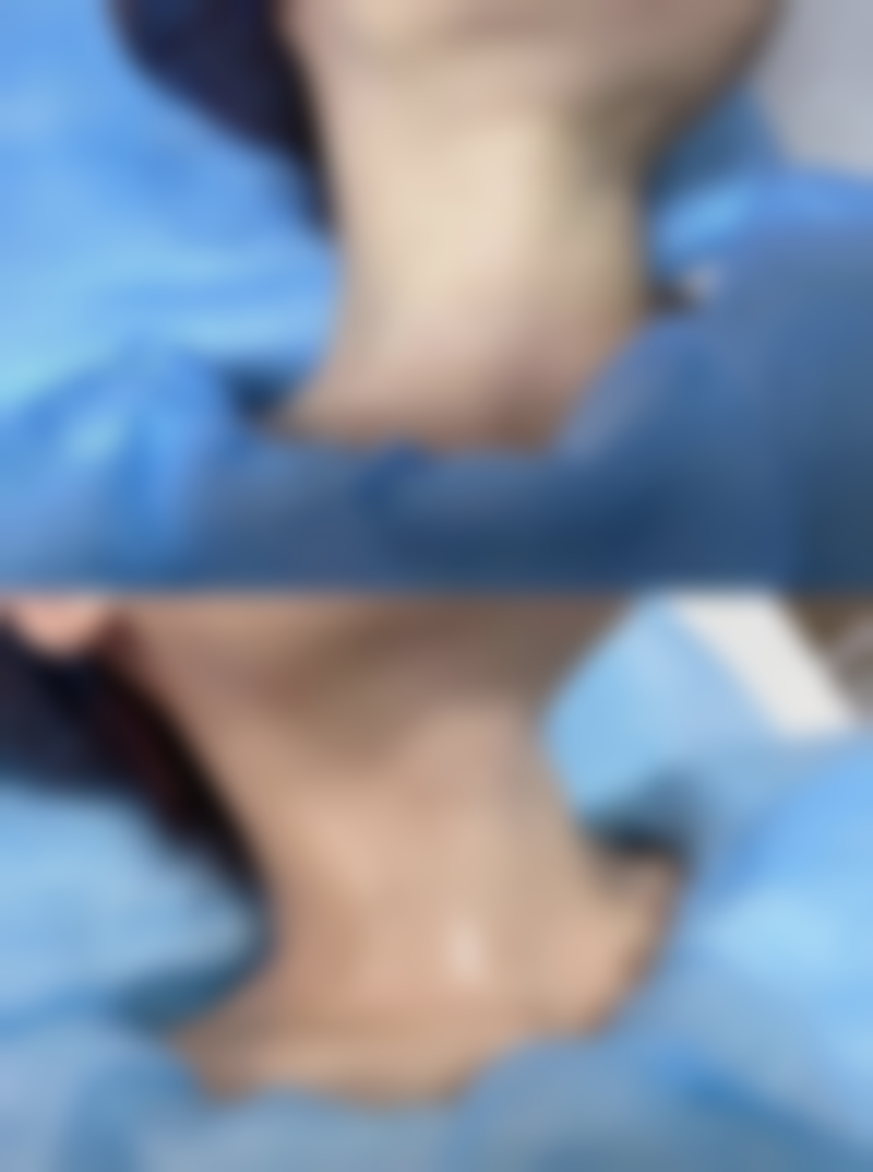 邢丽君项目价格表参考