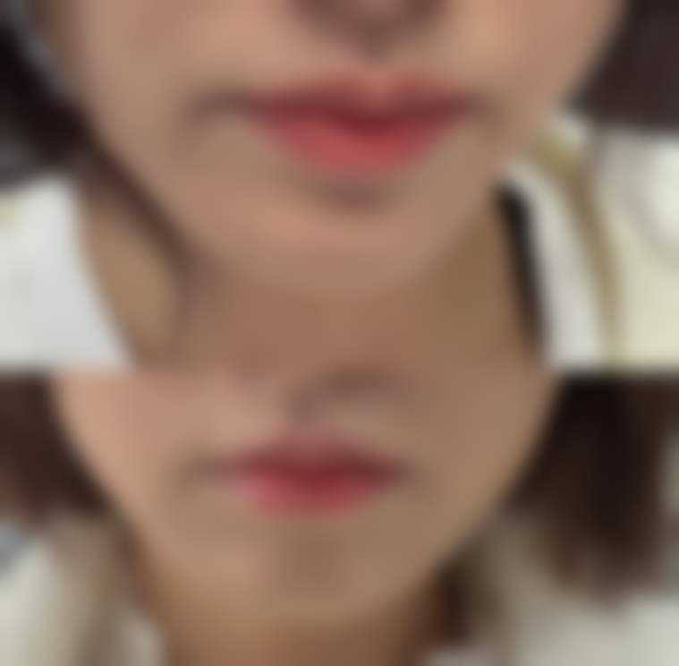 朱红芳怎么预约？