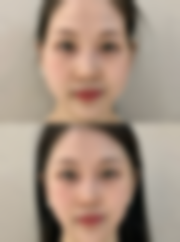 四、合肥光美医疗整形美容门诊部实例