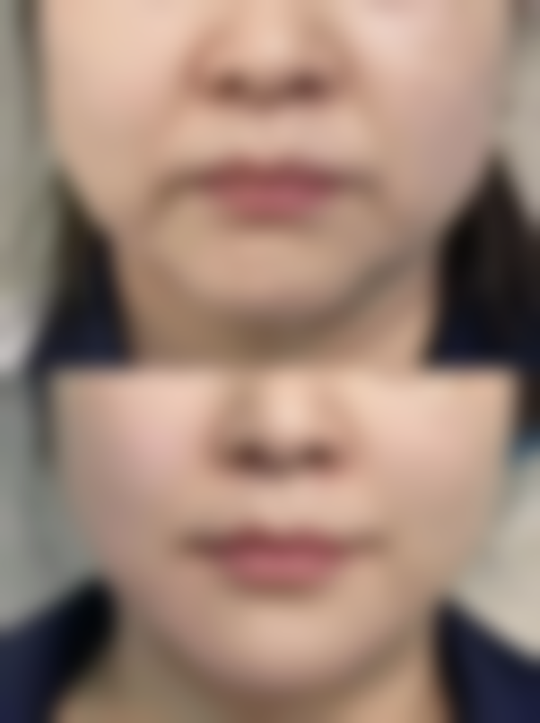 六、周口垣梦整形医疗美容门诊部怎么预约：