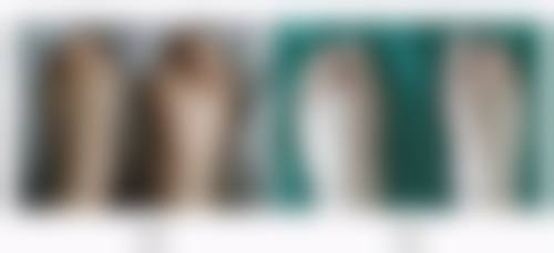 拯救双眼皮下垂难题！选对方法特别重要