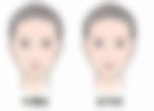 五、宿州容颜医疗美容诊所怎么预约：