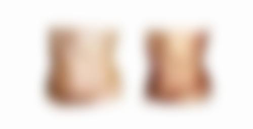 四、上海浦东新区摩尔齿科整形（塘桥总店）实例