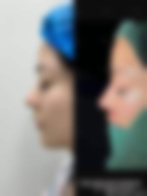 四、郑州阳光创美杨小顺整形美容诊所实例