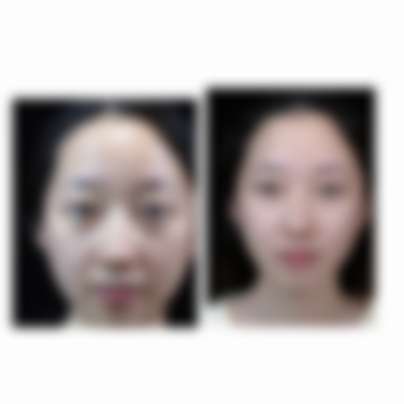 六、杭州伊颜瑞沐整形医院价格表：（仅供参考）