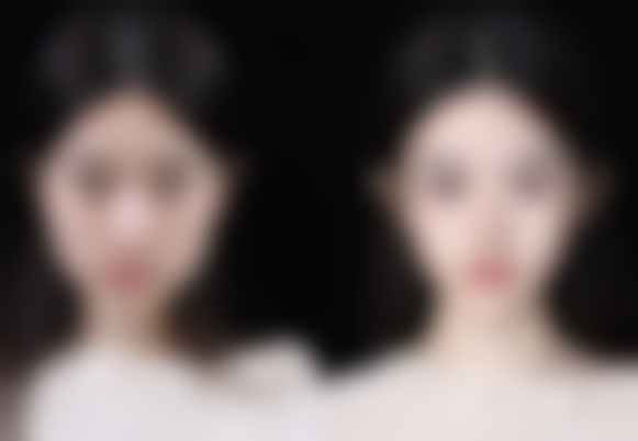 嗨体打泪沟成眼袋别慌！实用改善建议来啦