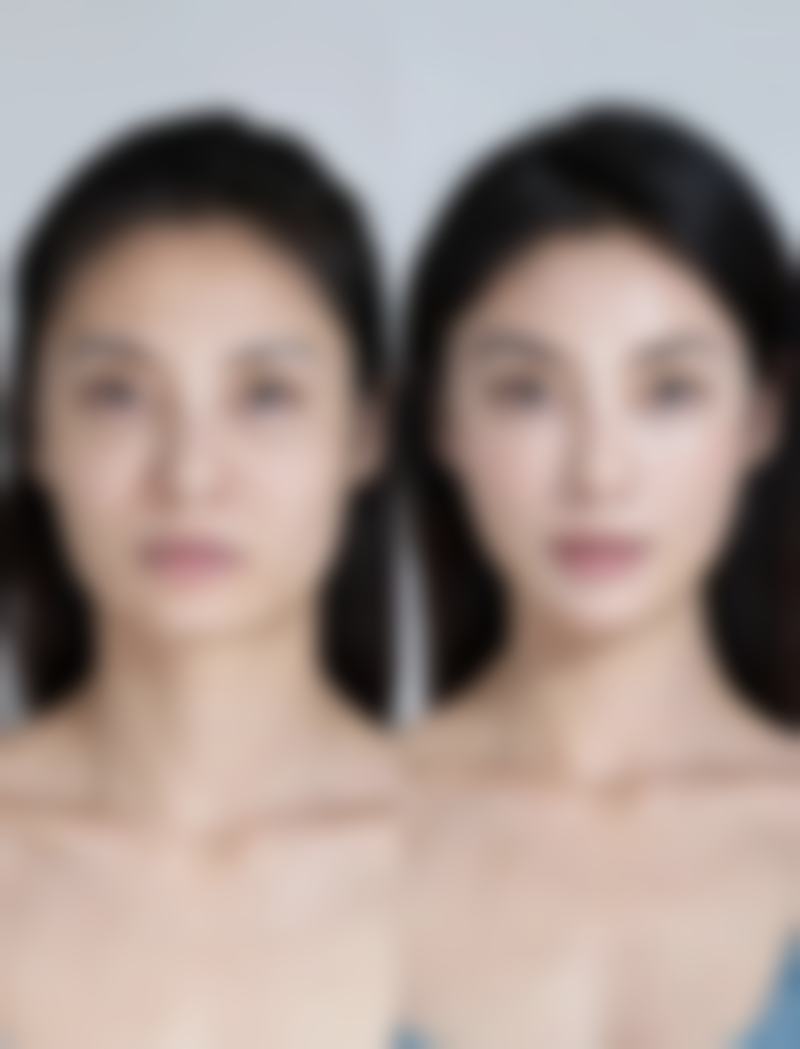 50岁女性隆胸:实现自然美胸梦