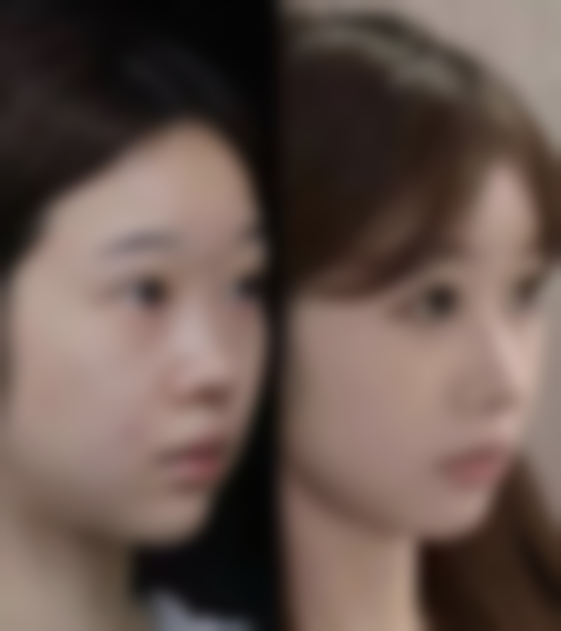 七、杭州伊颜瑞沐整形医院真实的顾客评价如下：