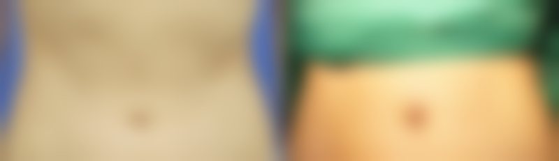 选对医院，为修复保驾护航