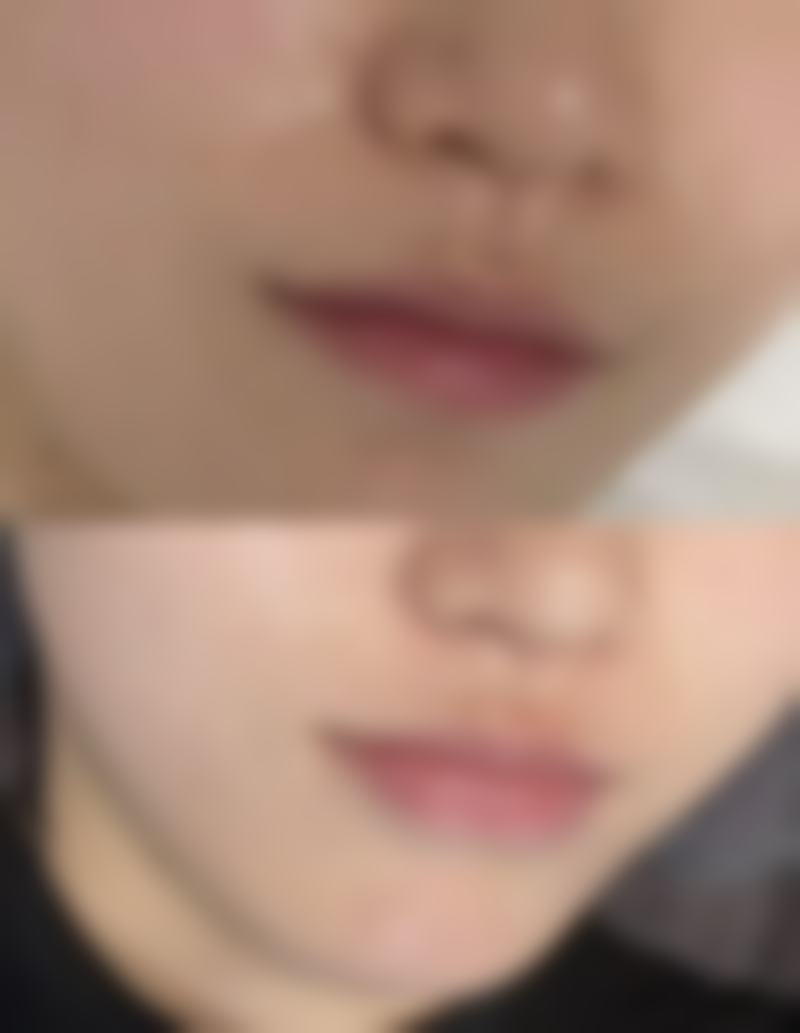 六、上海浦东新区摩尔齿科整形（塘桥总店）价格表：（仅供参考）