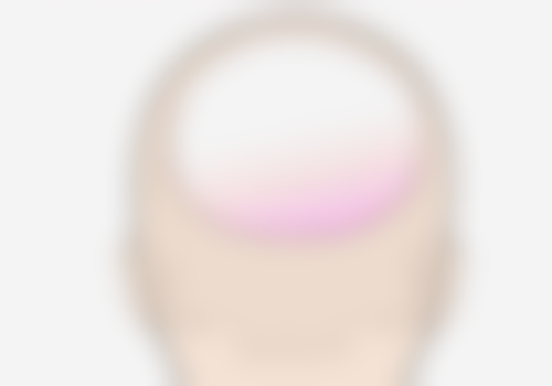 优质医院助力：为肌肤修复保驾护航