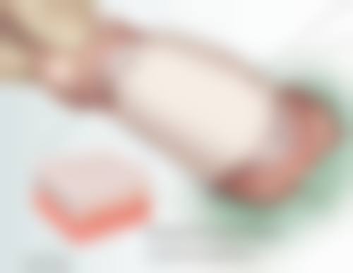 双眼皮手术缝线巧拆除之理想成效看得见