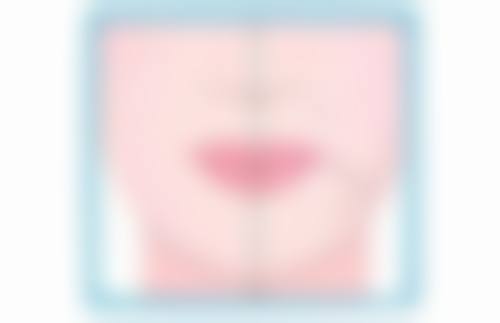 坚持治疗,疤痕改善不是梦