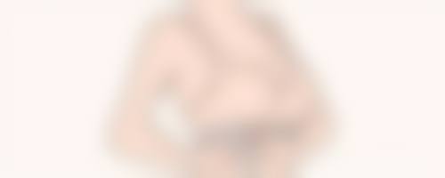 五、青岛瑧妍美医疗美容医院实例