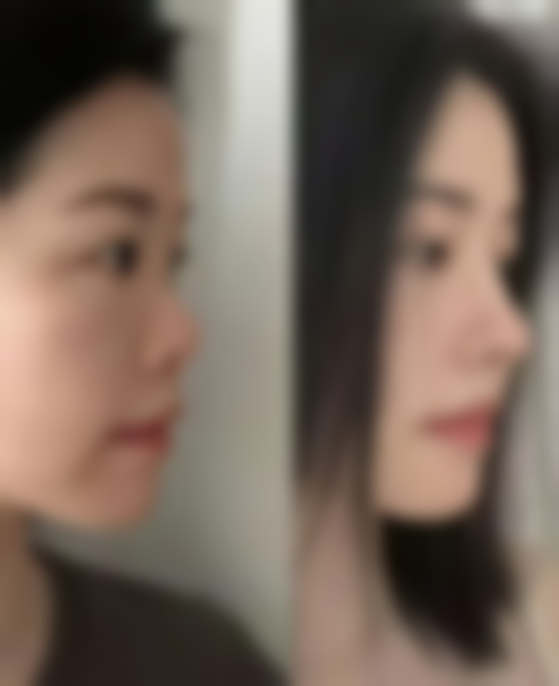 七、芜湖昊阳整形医院真实的顾客评价如下：