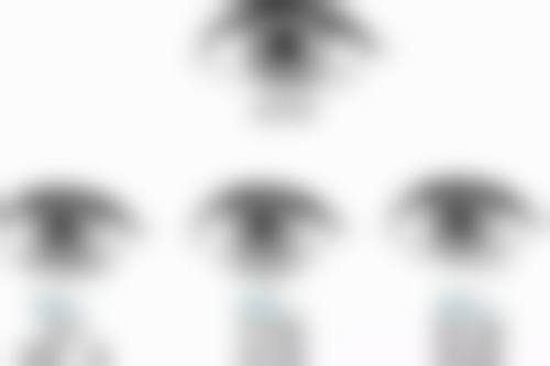 隆鼻手术医院选择攻略