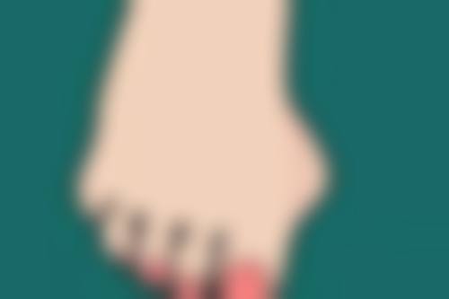 一只双眼皮不好看？手术改善有妙招