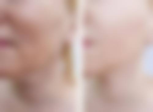 五、济南历下区人民医院整形外科实例