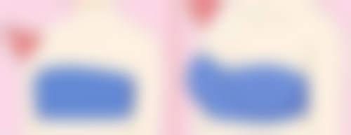 凹陷性疤痕怎么改善?这些医美方案来帮忙