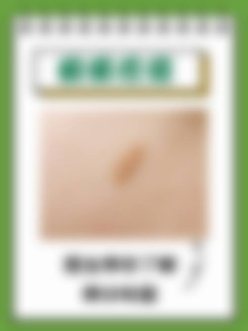 冯少清复杂瘢痕畸形修复水平怎么样可靠吗？