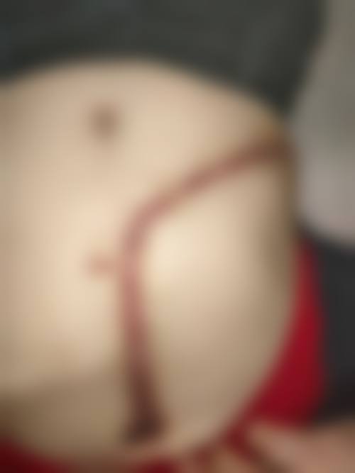 冯少清在哪家医院