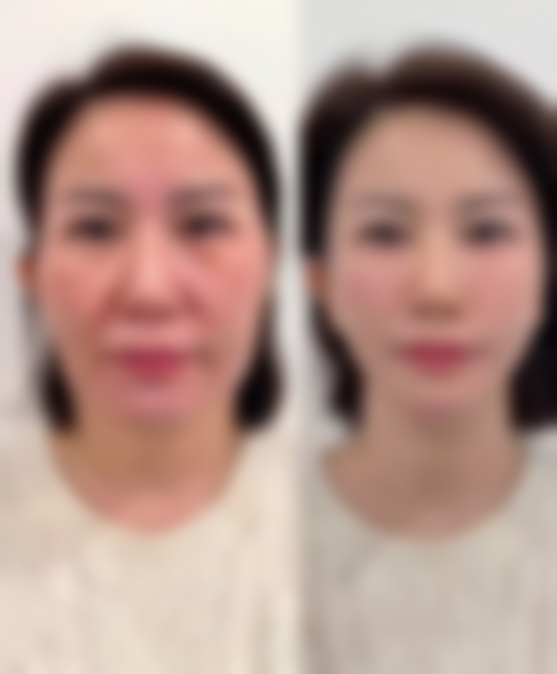 四、济南历下区人民医院整形外科开展的项目：