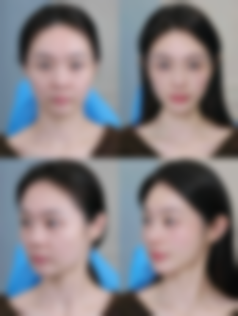 额头有疤痕别发愁,辅助修复加耐心成效好