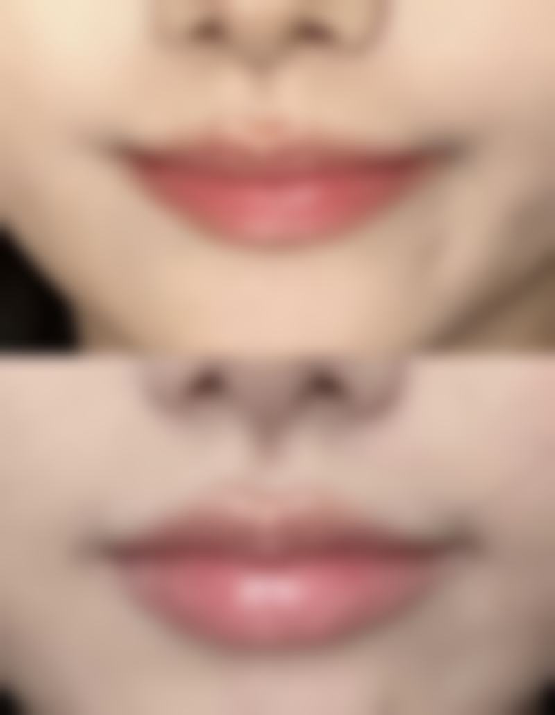 补充天然植物雌激素食物，维持阴道黏膜活力