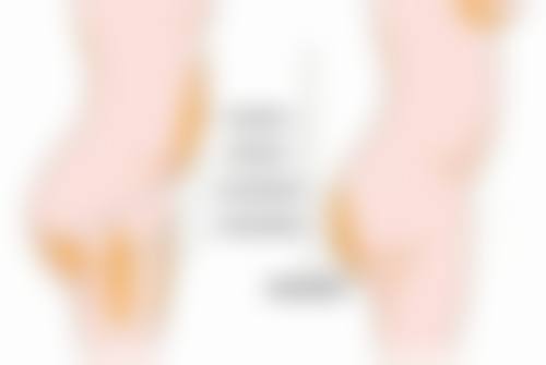 面部除皱用玻尿酸，填充静态纹超厉害