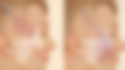 抽脂抽出的脂肪能带走吗？常见的脂肪处理方式