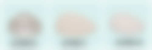 去眼袋手术恢复时间大揭秘：3 - 6 个月稳定，不同术式恢复差异及护理要点全知晓 